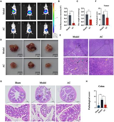 Astragalus mongholicus Bunge and Curcuma aromatica Salisb. modulate gut microbiome and bile acid metabolism to inhibit colon cancer progression